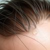 minoxidil-shedding | آرالیا | آرالیا شاپ - آرایشی بهداشتی